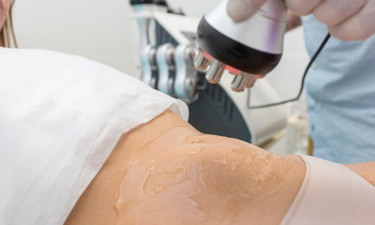 ¿Qué tipo de gel puedo usar para radiofrecuencia?
